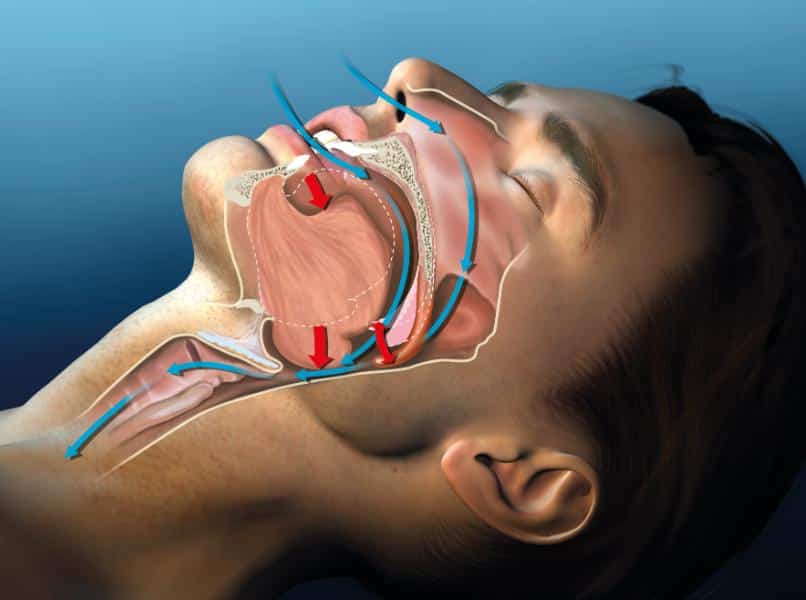 Airway-Centric Dentistry 2