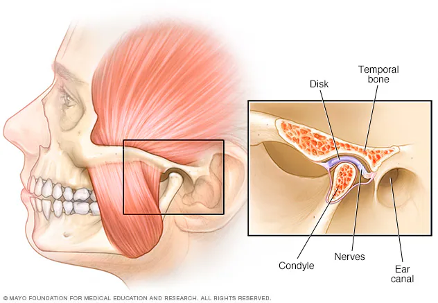 Jaw Pain Treatment