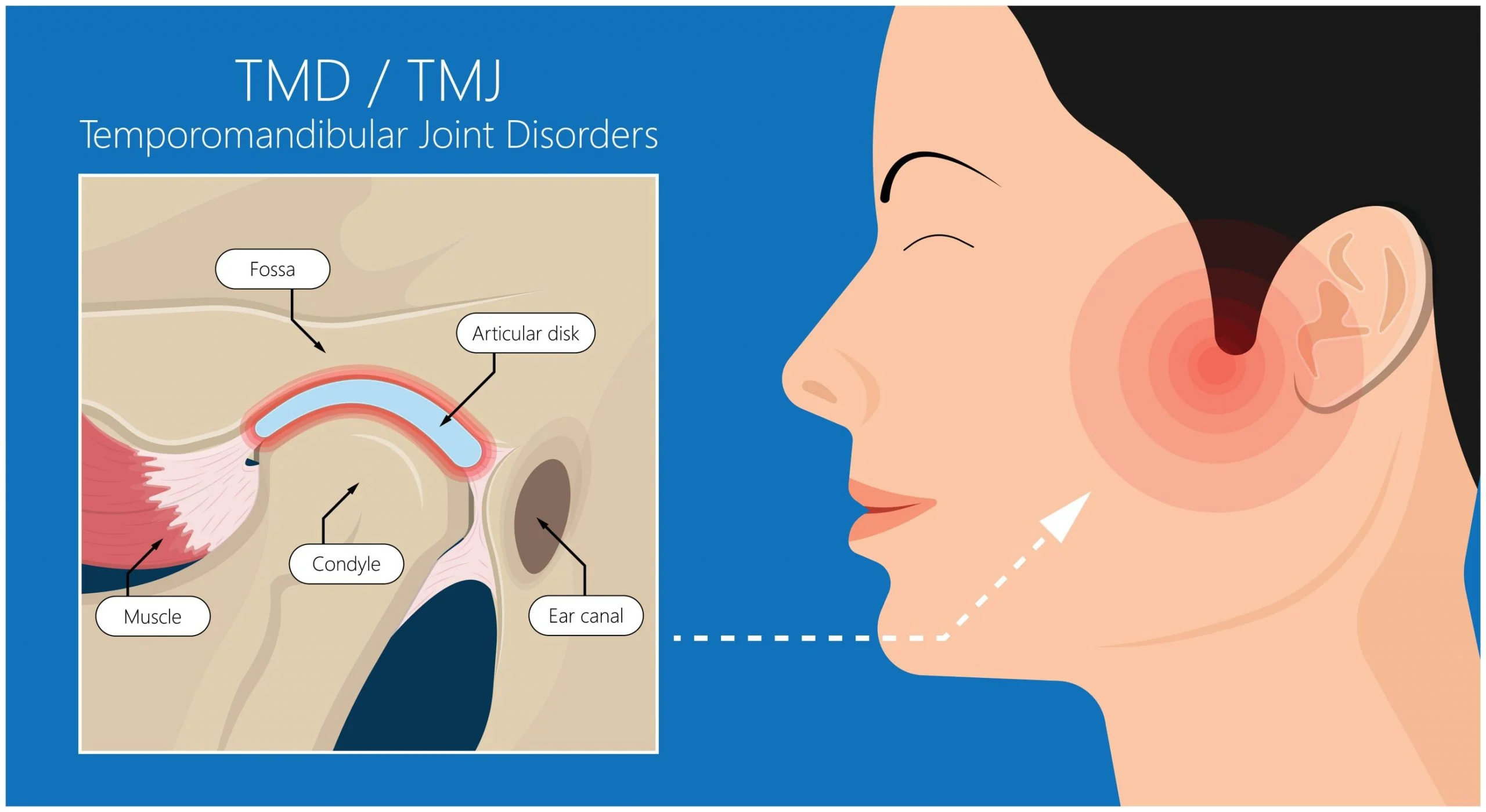 TMJ Examination