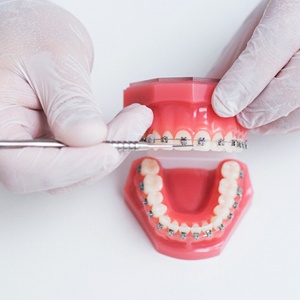 Comprehensive orthodontic treatment