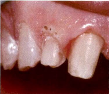 Laser Dentistry image 2