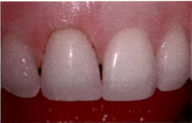 Aftercare and follow up