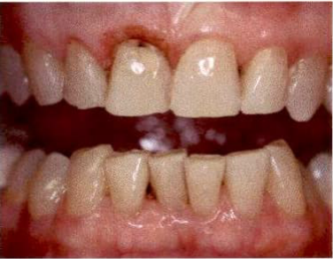Clinical example laser 7