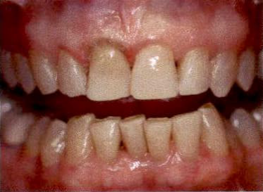 Clinical example laser 8