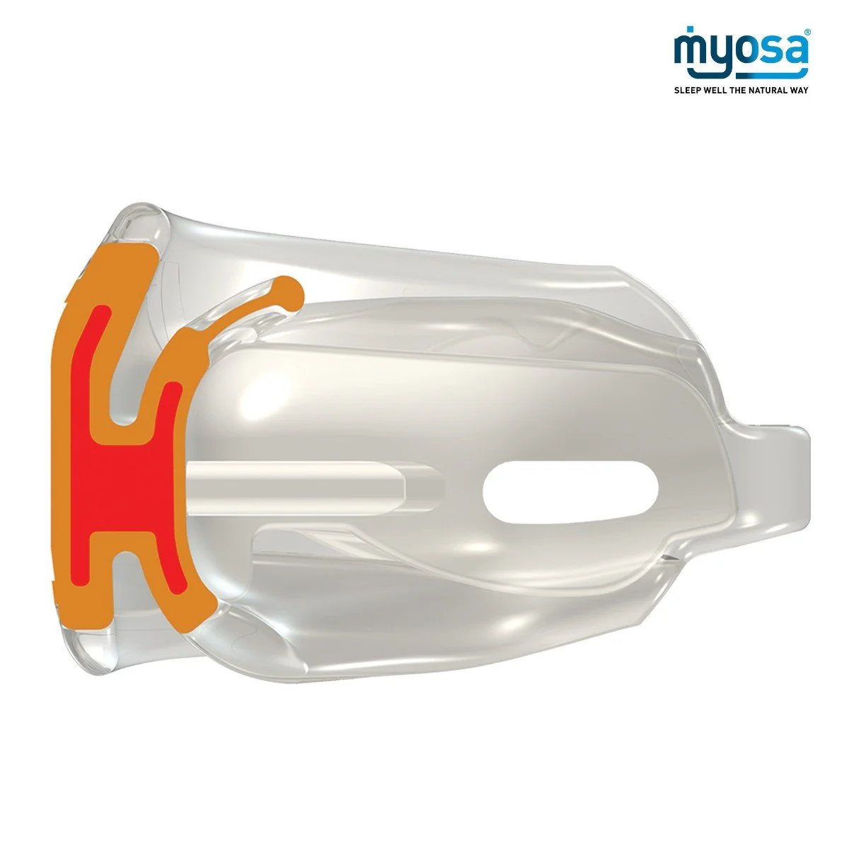 Results of Myosa Treatment