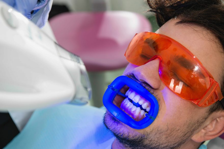 Professional teeth whitening treatment