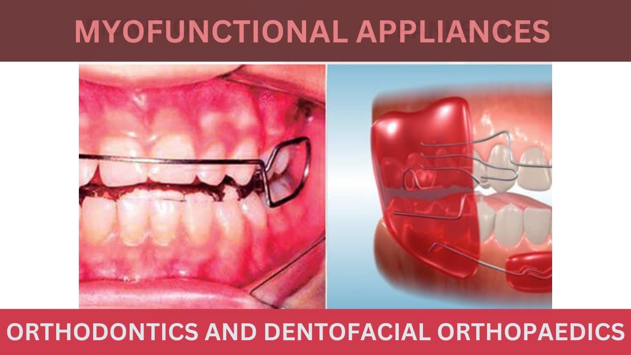 Myosa Appliance for Children