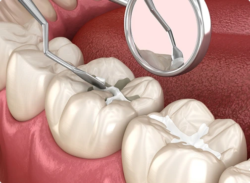 Preventative Dental Treatment