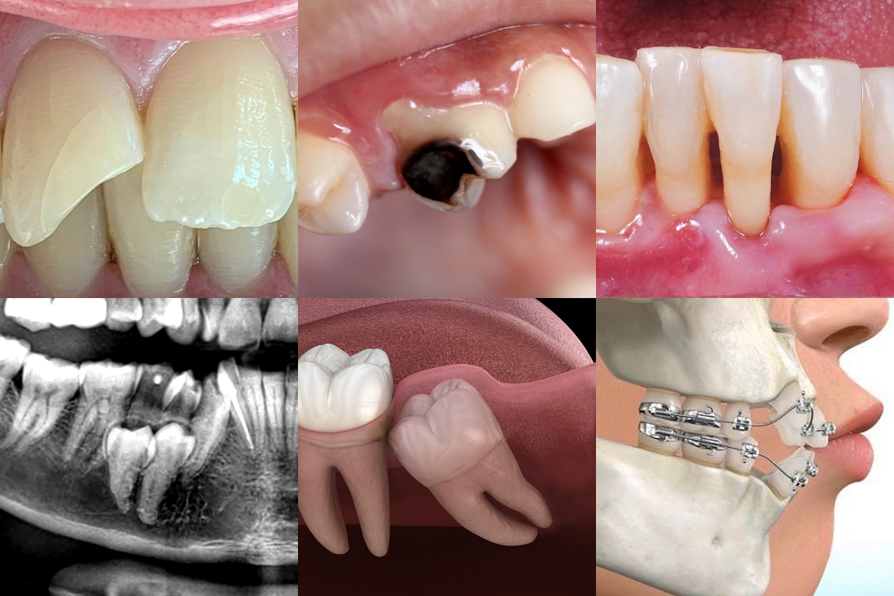Professional Oral Surgery Procedure
