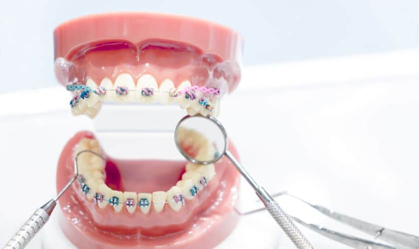 Interceptive Orthodontics